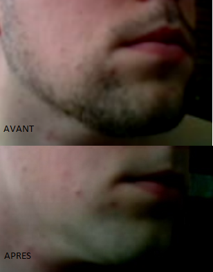 avant